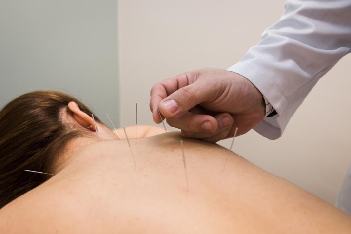 Foto 4g Acupuntura sistemica .jpg